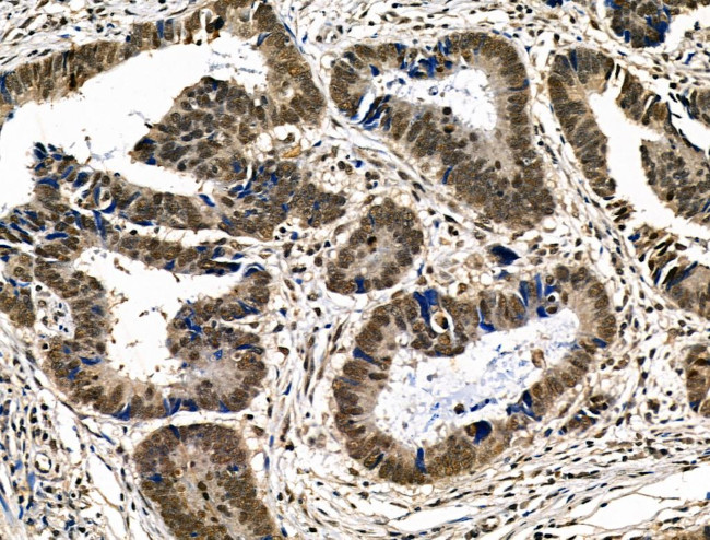 Phospho-p300 (Ser1834) Antibody in Immunohistochemistry (Paraffin) (IHC (P))