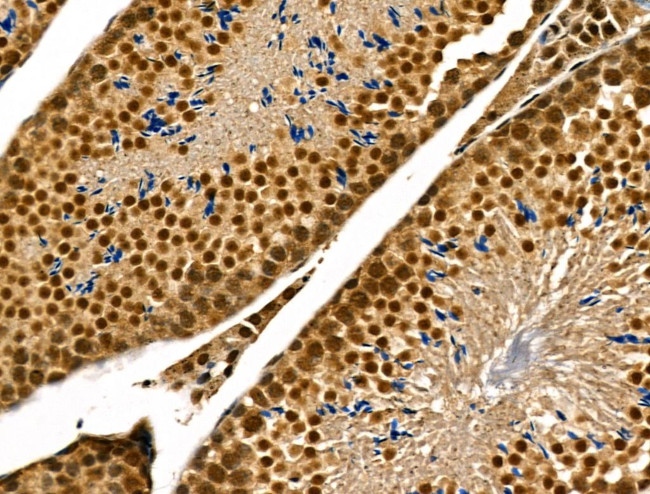 Phospho-p300 (Ser1834) Antibody in Immunohistochemistry (Paraffin) (IHC (P))