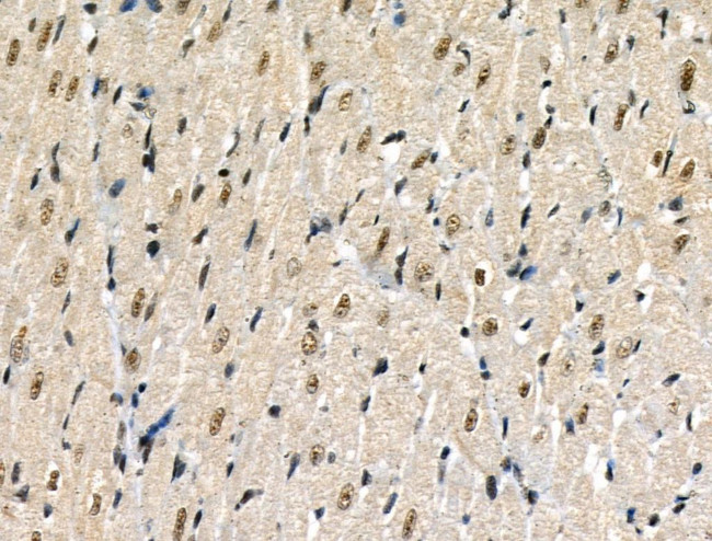 Phospho-p300 (Ser1834) Antibody in Immunohistochemistry (Paraffin) (IHC (P))