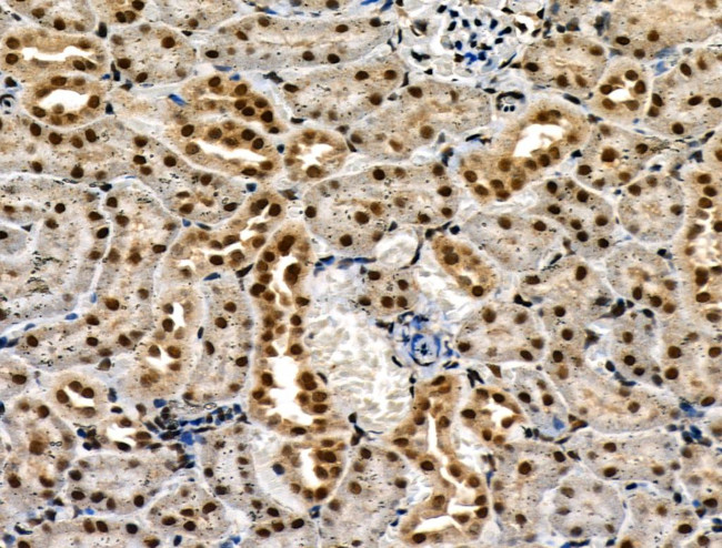 Phospho-p300 (Ser1834) Antibody in Immunohistochemistry (Paraffin) (IHC (P))