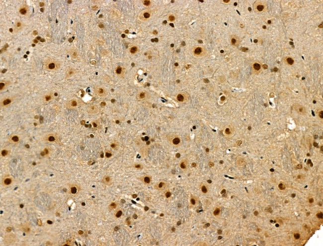 Phospho-p300 (Ser1834) Antibody in Immunohistochemistry (Paraffin) (IHC (P))