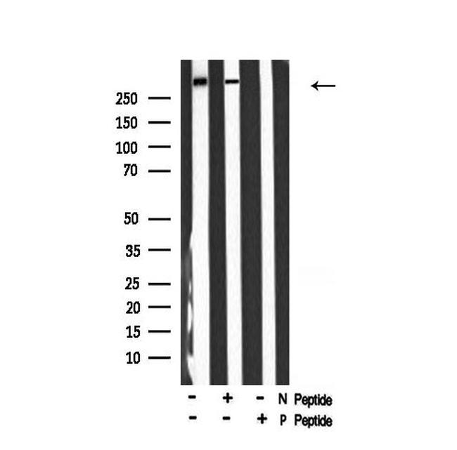 Phospho-p300 (Ser1834) Antibody in Western Blot (WB)