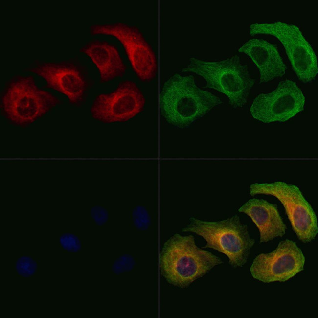 Phospho-L-Plastin (Ser5) Antibody in Immunocytochemistry (ICC/IF)