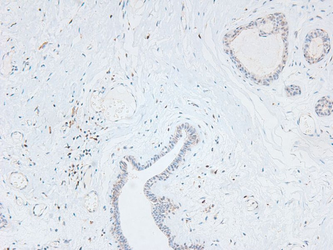 Phospho-L-Plastin (Ser5) Antibody in Immunohistochemistry (Paraffin) (IHC (P))