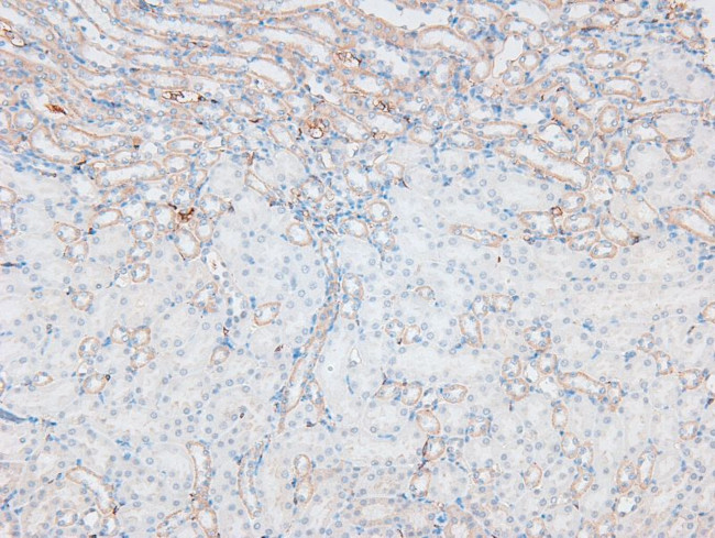 Phospho-L-Plastin (Ser5) Antibody in Immunohistochemistry (Paraffin) (IHC (P))