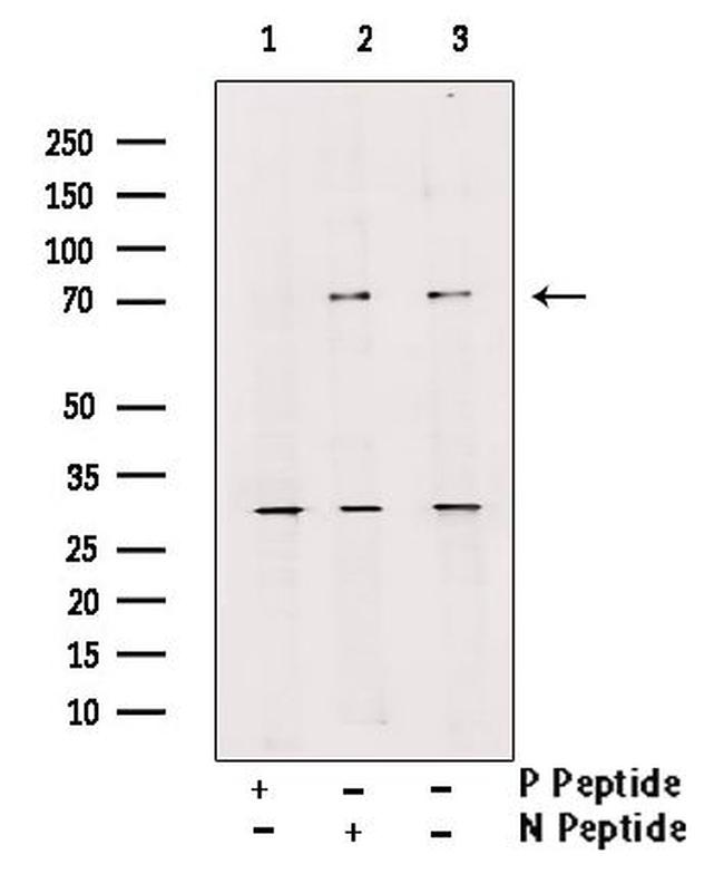 Phospho-L-Plastin (Ser5) Antibody in Western Blot (WB)