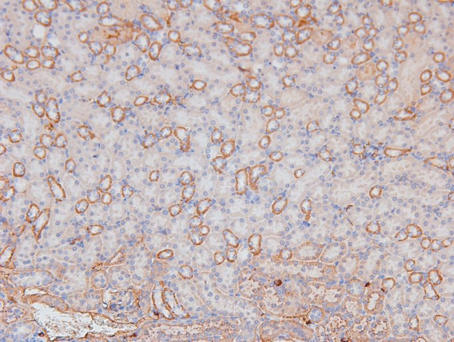 Phospho-KIF1C (Ser1092) Antibody in Immunohistochemistry (Paraffin) (IHC (P))