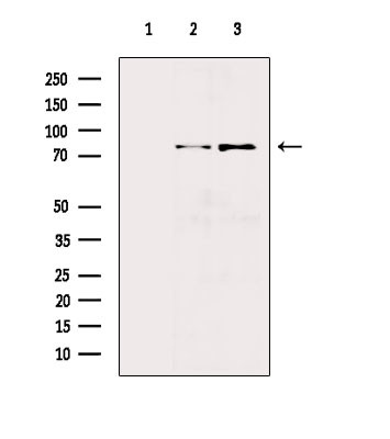 Phospho-PKD2 (Ser812) Antibody in Western Blot (WB)