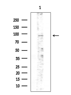 Phospho-PKD2 (Ser812) Antibody in Western Blot (WB)