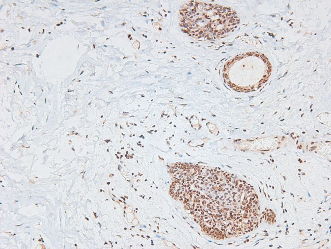 Phospho-CtIP (Ser664) Antibody in Immunohistochemistry (Paraffin) (IHC (P))