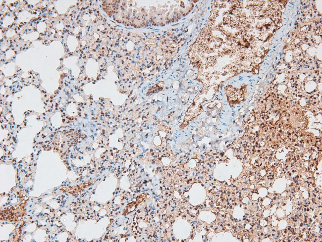 Phospho-CtIP (Ser664) Antibody in Immunohistochemistry (Paraffin) (IHC (P))