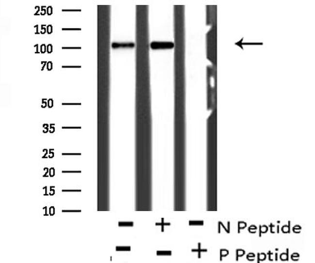 Phospho-CtIP (Ser664) Antibody in Western Blot (WB)