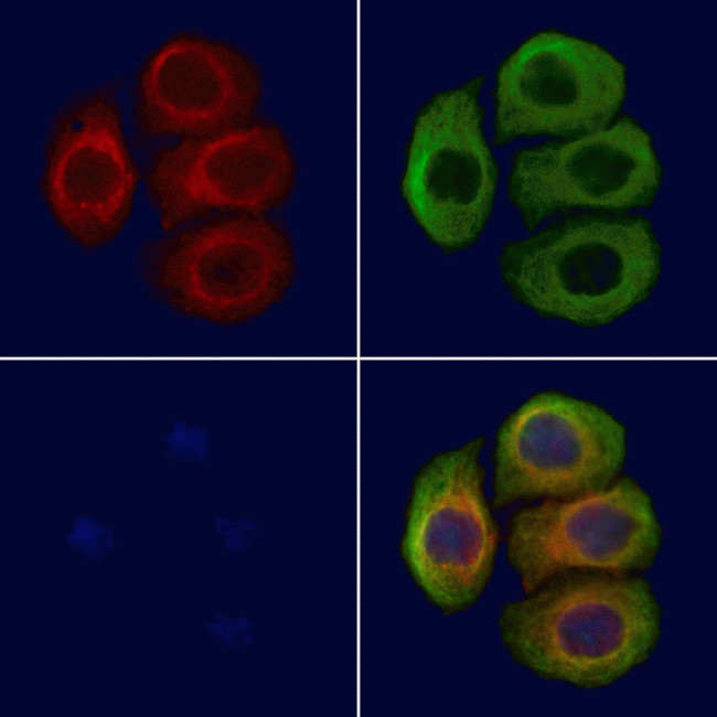 Phospho-VAMP4 (Ser30) Antibody in Immunocytochemistry (ICC/IF)