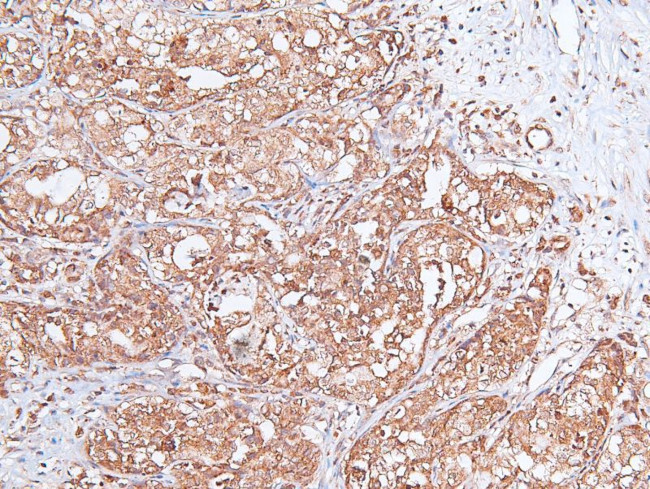 Phospho-VAMP4 (Ser30) Antibody in Immunohistochemistry (Paraffin) (IHC (P))