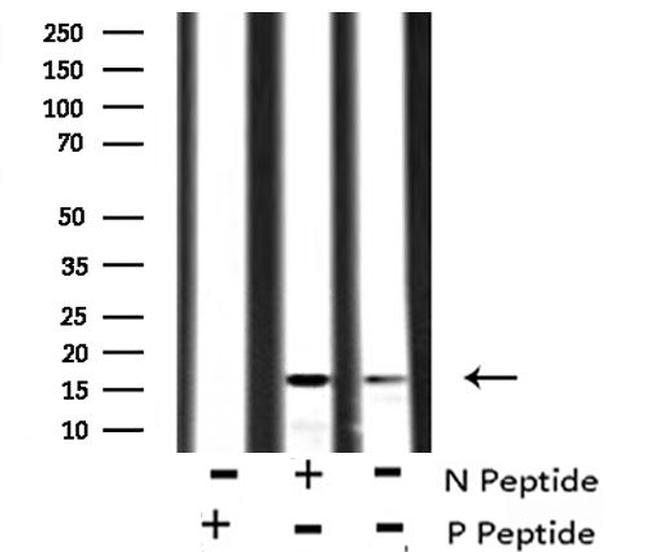 Phospho-VAMP4 (Ser30) Antibody in Western Blot (WB)