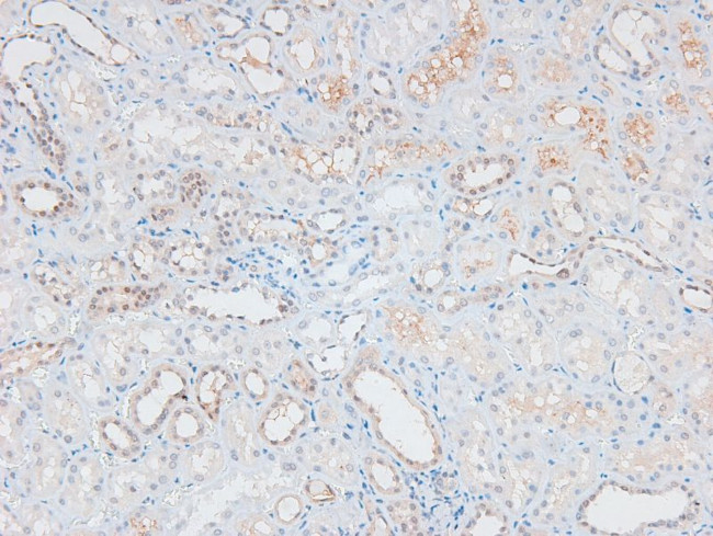 Phospho-ATM (Ser1893) Antibody in Immunohistochemistry (Paraffin) (IHC (P))