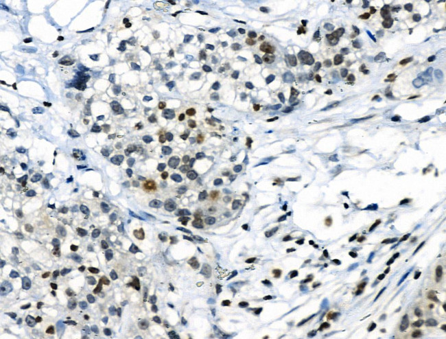 Phospho-CREB (Ser111) Antibody in Immunohistochemistry (Paraffin) (IHC (P))