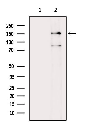 Phospho-Met (Ser985) Antibody in Western Blot (WB)