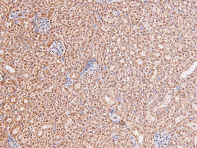 Phospho-STAT4 (Ser721) Antibody in Immunohistochemistry (Paraffin) (IHC (P))