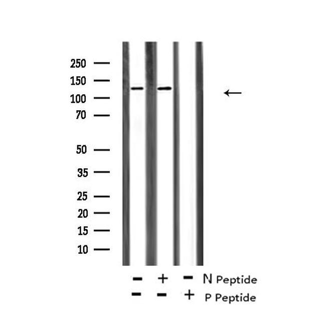 Phospho-ABL1/ABL2 (Tyr70, Tyr116) Antibody in Western Blot (WB)