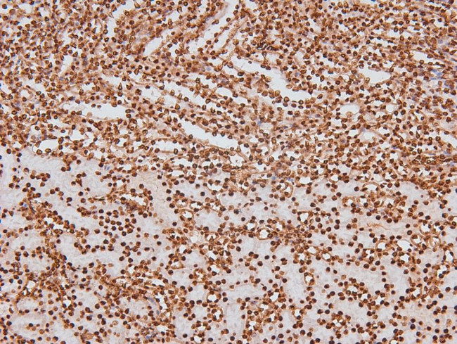 Phospho-CSK (Tyr304) Antibody in Immunohistochemistry (Paraffin) (IHC (P))