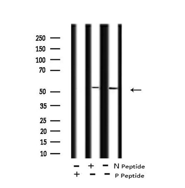 Phospho-CSK (Tyr304) Antibody in Western Blot (WB)