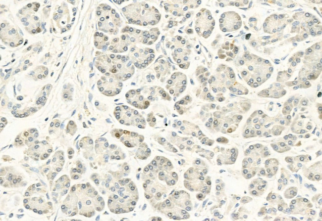 Phospho-DYRK1A/DYRK1B (Tyr321, Tyr273) Antibody in Immunohistochemistry (Paraffin) (IHC (P))