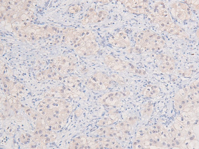 Phospho-DYRK1A/DYRK1B (Tyr321, Tyr273) Antibody in Immunohistochemistry (Paraffin) (IHC (P))