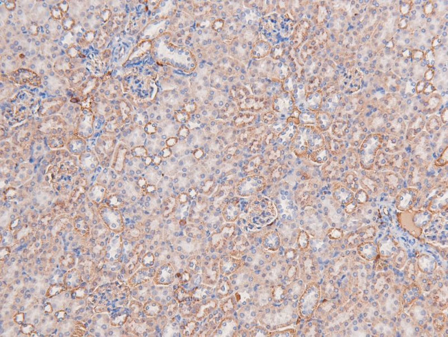 Phospho-DYRK1A/DYRK1B (Tyr321, Tyr273) Antibody in Immunohistochemistry (Paraffin) (IHC (P))