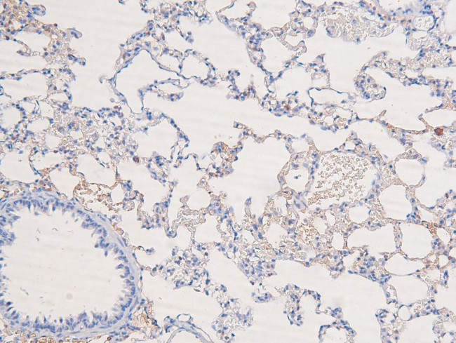 Phospho-DYRK1A/DYRK1B (Tyr321, Tyr273) Antibody in Immunohistochemistry (Paraffin) (IHC (P))