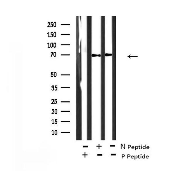 Phospho-DYRK1A/DYRK1B (Tyr321, Tyr273) Antibody in Western Blot (WB)