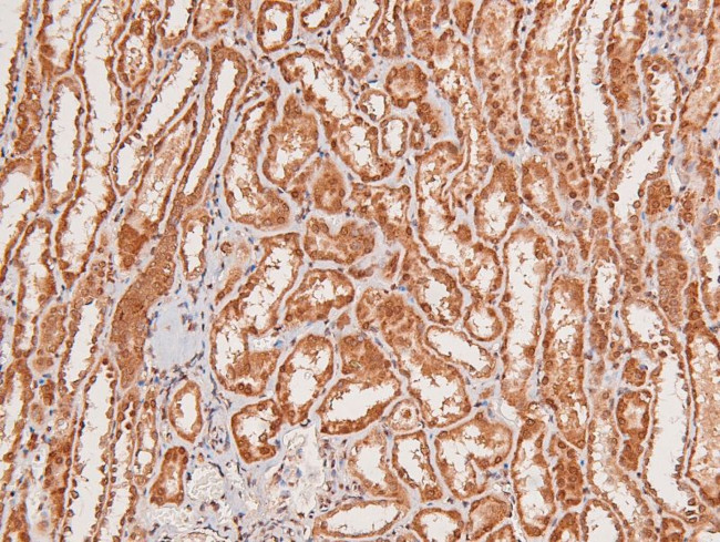 Phospho-EphA8 (Tyr839) Antibody in Immunohistochemistry (Paraffin) (IHC (P))