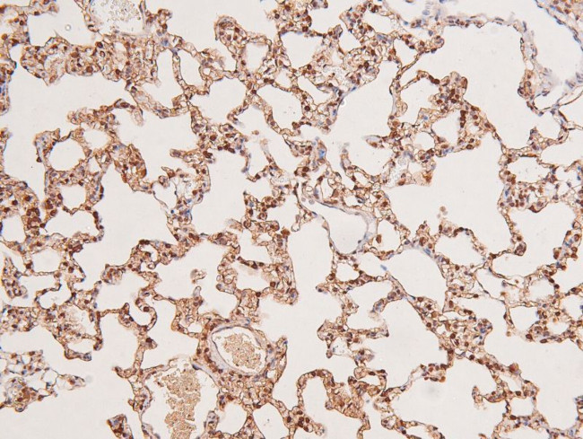 Phospho-EphA8 (Tyr839) Antibody in Immunohistochemistry (Paraffin) (IHC (P))