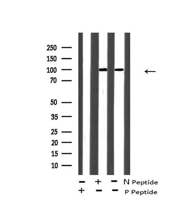 Phospho-EphA8 (Tyr839) Antibody in Western Blot (WB)