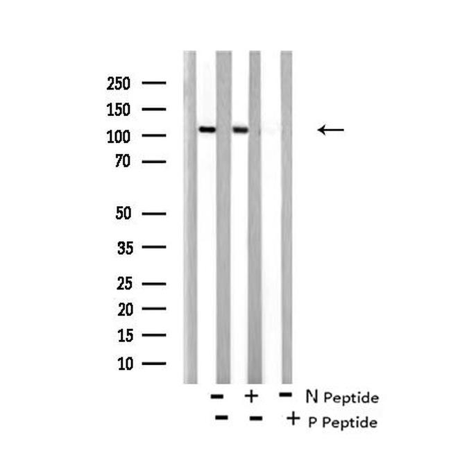 Phospho-EphA8 (Tyr616) Antibody in Western Blot (WB)