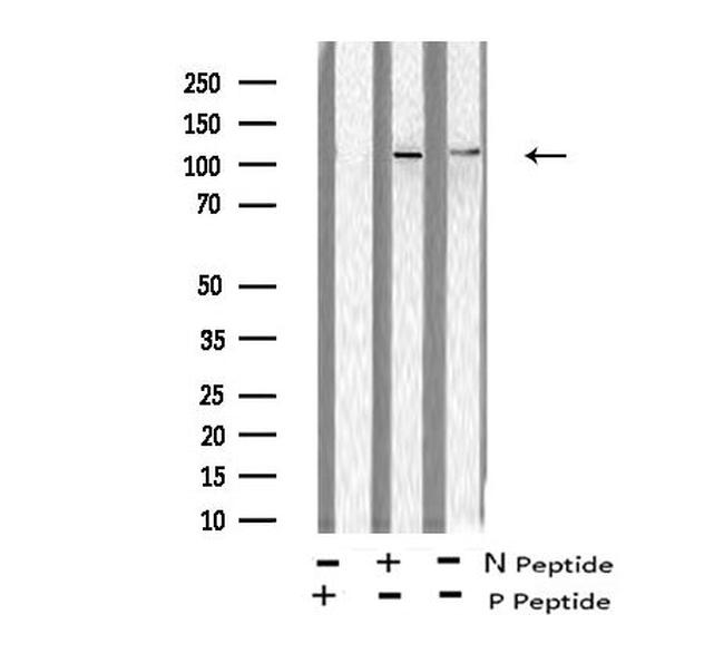 Phospho-EphB1/EphB2/EphB3/EphB4 (Tyr600, Tyr602, Tyr614, Tyr596) Antibody in Western Blot (WB)