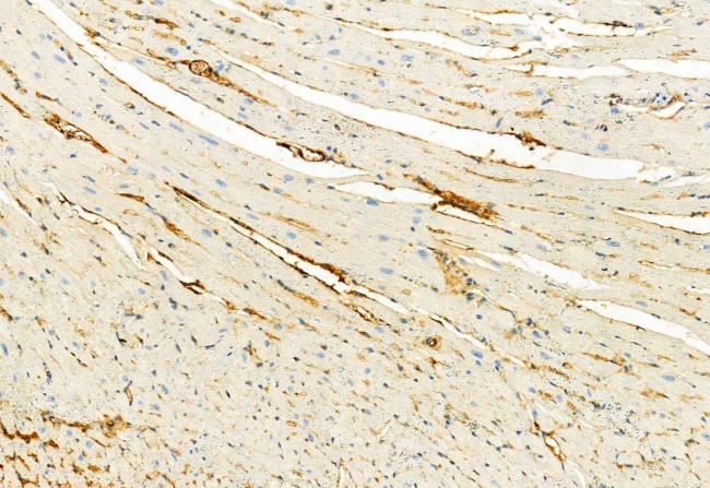 Phospho-FGFR2 (Tyr769) Antibody in Immunohistochemistry (Paraffin) (IHC (P))