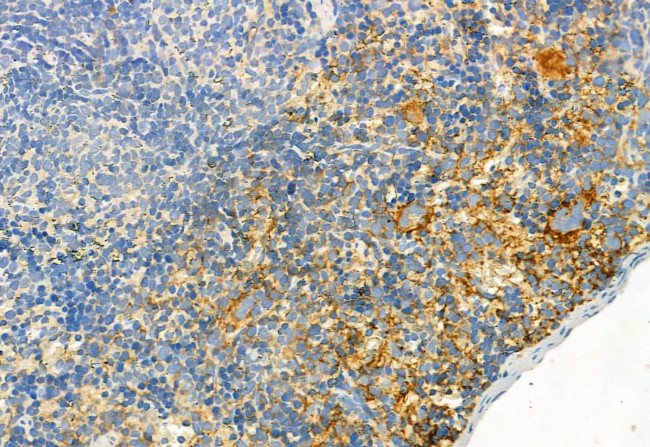 Phospho-FGFR2 (Tyr769) Antibody in Immunohistochemistry (Paraffin) (IHC (P))