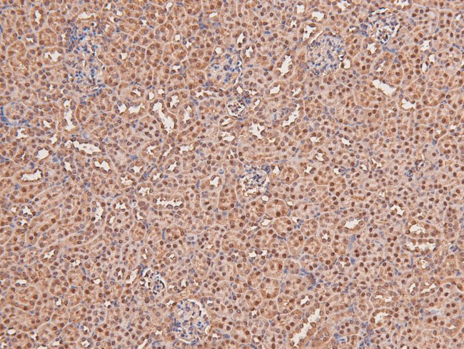 Phospho-FGFR2 (Tyr769) Antibody in Immunohistochemistry (Paraffin) (IHC (P))