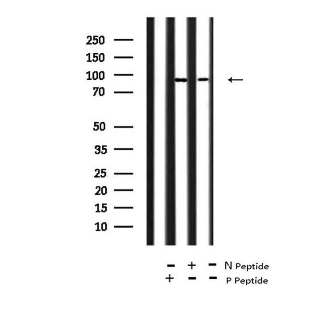 Phospho-FGFR2 (Tyr769) Antibody in Western Blot (WB)