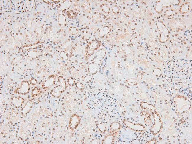 Phospho-FGR (Tyr412) Antibody in Immunohistochemistry (Paraffin) (IHC (P))