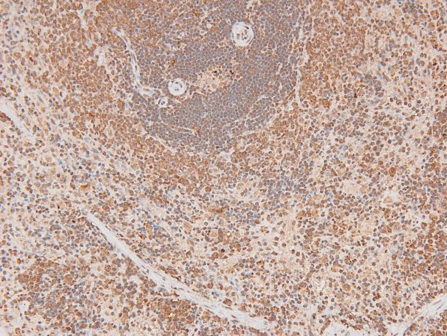 Phospho-FGR (Tyr412) Antibody in Immunohistochemistry (Paraffin) (IHC (P))