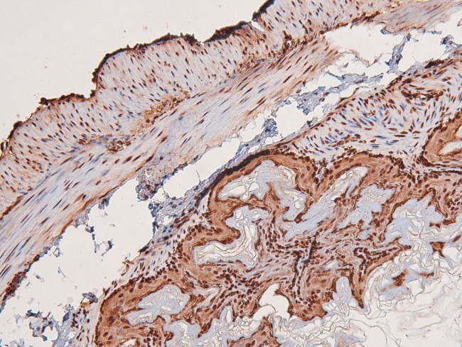 Phospho-HIPK1/HIPK2/HIPK3 (Tyr352, Tyr361, Tyr359) Antibody in Immunohistochemistry (Paraffin) (IHC (P))