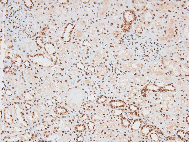 Phospho-JAK2 (Tyr119) Antibody in Immunohistochemistry (Paraffin) (IHC (P))