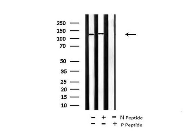 Phospho-JAK2 (Tyr119) Antibody in Western Blot (WB)