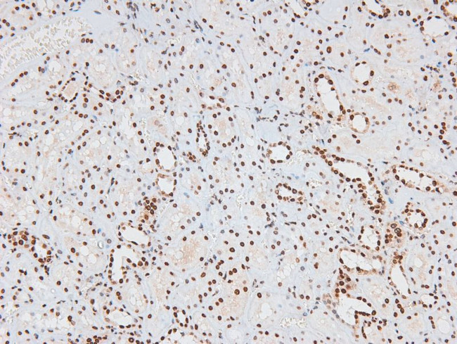 Phospho-JAK2/JAK3 (Tyr966, Tyr939) Antibody in Immunohistochemistry (Paraffin) (IHC (P))