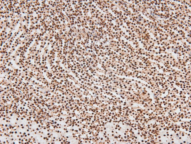 Phospho-JAK2/JAK3 (Tyr966, Tyr939) Antibody in Immunohistochemistry (Paraffin) (IHC (P))