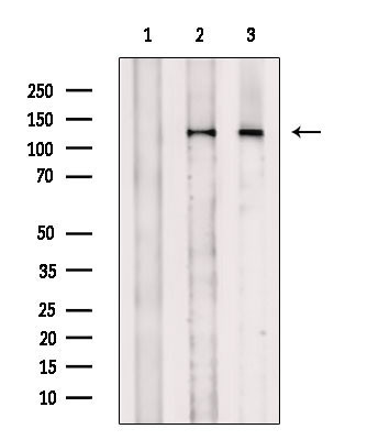 Phospho-JAK3 (Tyr904) Antibody in Western Blot (WB)