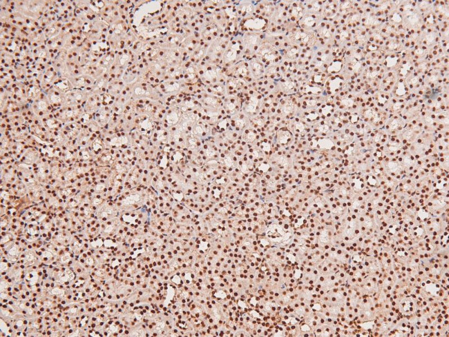 Phospho-JAK3 (Tyr904) Antibody in Immunohistochemistry (Paraffin) (IHC (P))