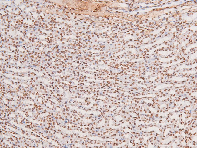 Phospho-JAK3 (Tyr904) Antibody in Immunohistochemistry (Paraffin) (IHC (P))